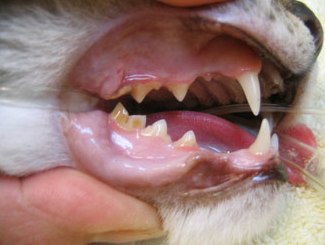 tartar-on-teeth